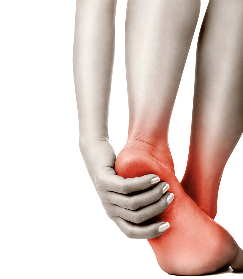 Plantar Fasciitis in Syracuse, NY and Central New York Area